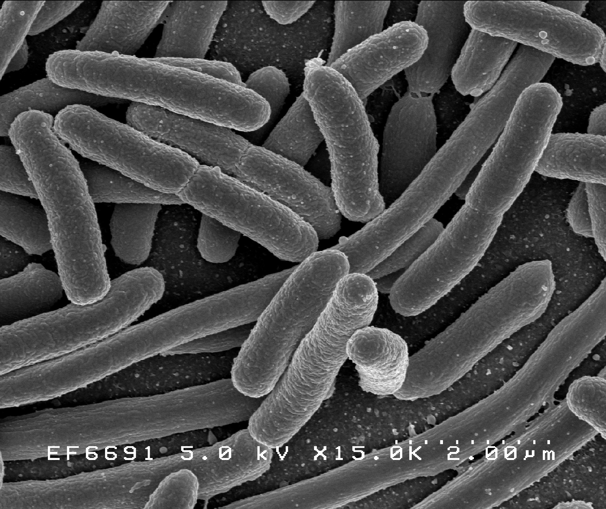 e_coli.jpg